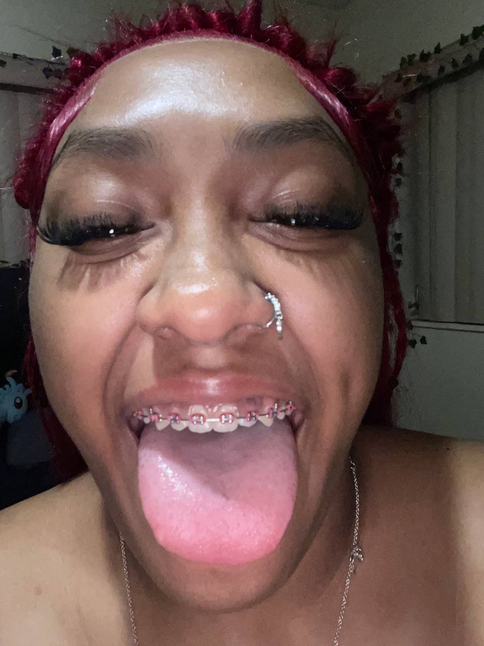 BBW Braces #9otLim4c