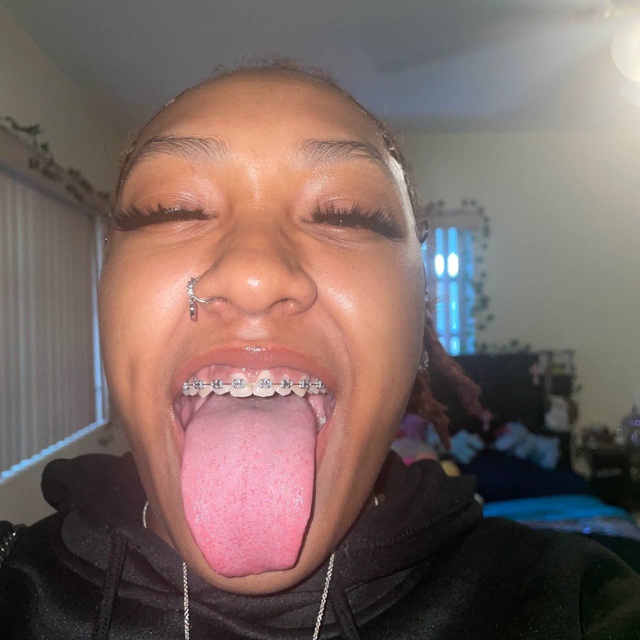 BBW Braces #Q0zyjeXf
